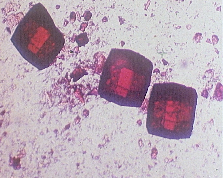 Cristallisation d'un enzyme à température élevée T ° > 30°
