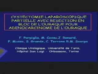 Cystectomie laparoscopique partielle avec résection en bloc de l'ouraque pour adénocarcinome de l'ouraque