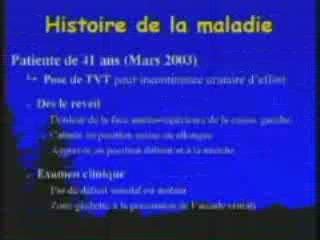 Neurolyse coelioscopique d'une compression du nerf obturateur gauche par une bandelette tvt