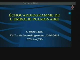 DIU d'Echocardiographie - Echocardiogramme de l'embolie pulmonaire